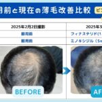 レス1番のサムネイル画像