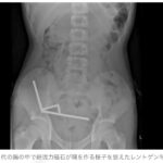 レス1番の画像1