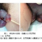 レス2番の画像1