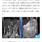 レス11番の画像1