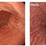 レス2番の画像1